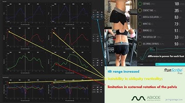 RunScribe 3D pelvis kinematic interpretation
