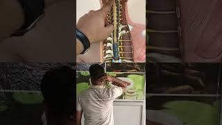 Cervical problem lower back pain treatment ## shorts # sciatica # neckpain #backpain !