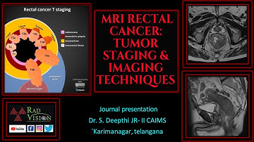 MRI RECTAL CANCER-TUMOR STAGING AND IMAGING TECHNIQUES