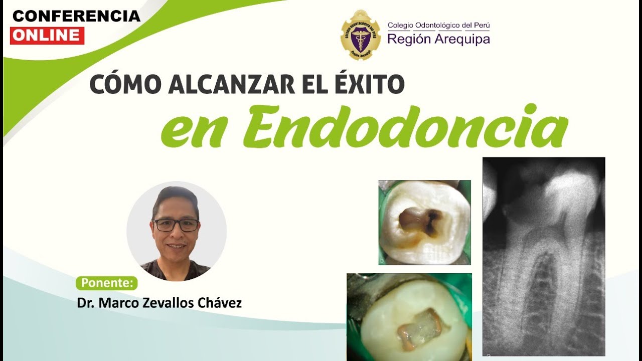CONFERENCIA - CÓMO ALCANZAR EL ÉXITO EN ENDODONCIA