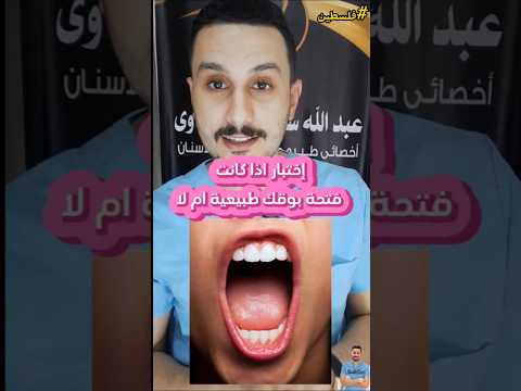 هل تعاني من صعوبة فتح الفم إليك إختبار يوضح اذا كان مفصل الفك سليم ام لأ تعالى أقولك الحلقة الاولى