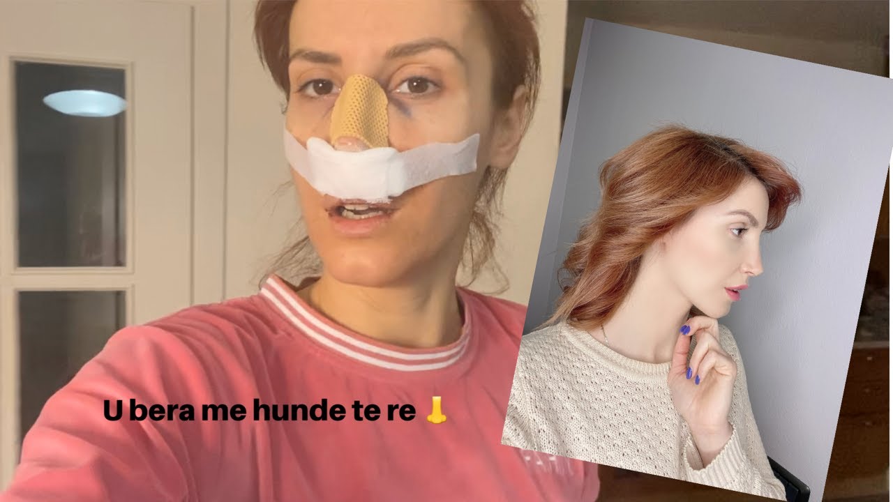 I bera vetes dhurate nje hunde te re... Gjithe eksperienca e dokumentuar ne kete video