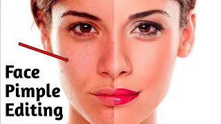 Pimple Face Editing | Face Editing Tutorial | How To clean Face | Skin Editing screenshot 5