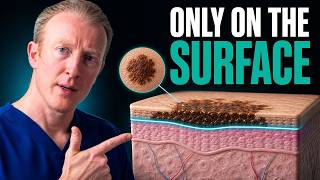 Is Melanoma In Situ Actually Cancer? (Stage 0)