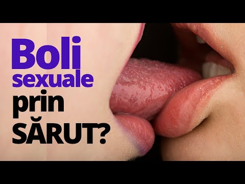 Video: 3 moduri de a recunoaște simptomele Chlamydia (pentru bărbați)