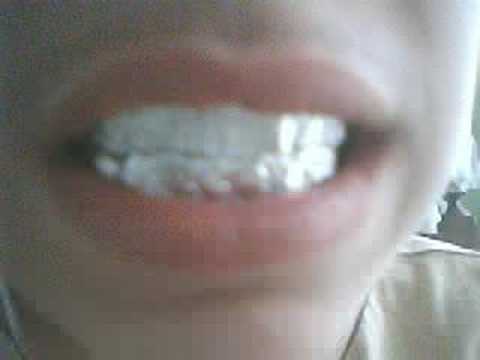 New Fake Grillz Lol New Fake Grillz Lol