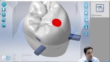 MillBox 2019 - Hybrid Abutment and Screw Retained Workflow