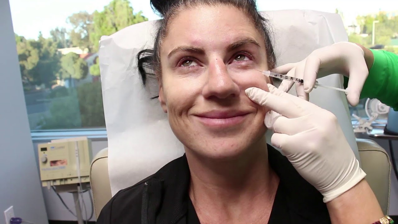 Banner for Dysport Injections to the Glabella, Crow's Feet and Bunny Lines