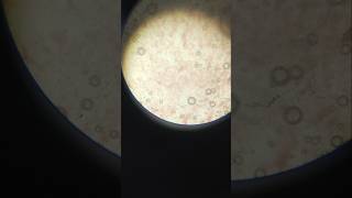 staining of.bacteria