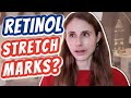 Vlog: RETINOL FOR STRETCH MARKS?| Dr Dray