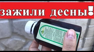 МОЩНЫЙ ЭФФЕКТ! Зажили ДЕСНЫ, И ПАРОДОНТОЗ  Исчез! - Видео от КоЗяПуЛьКа КоЗяПуЛьКа