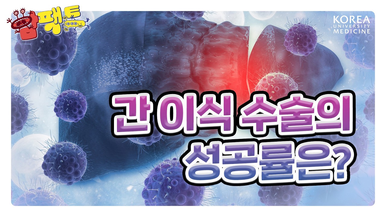 📈높은 유병률과 사망률의 간암! 간 이식 수술에서 성공률은 어떨까?? | 간암에 대한 팩트체크! [암팩트🍄]