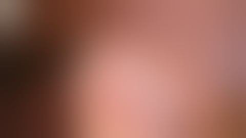 Appendectomy - Making Window in Mesoappendix