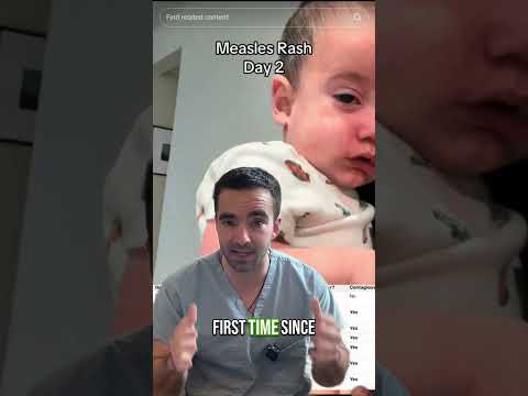 Your Baby Can Get The Measles Vaccine Earlier Than You Think!