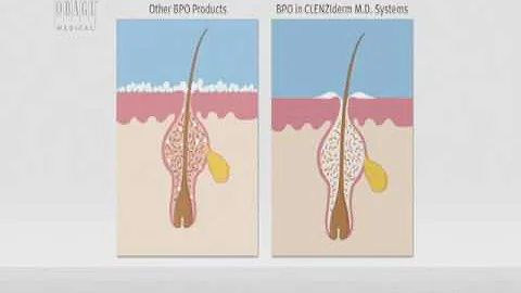 Obagi - Clenziderm.mov