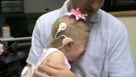 Cochlear Implants: People hearing for the first time!