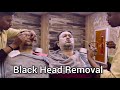 Black Head Removal Asmr Face Massage With Different type of cream By Vikram Barber