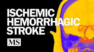 Introduction to Ischemic and Hemorrhagic Stroke (2025)