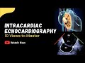 Intracardiac Echocardiography ICE - 10 Basic Views to Master
