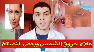 علاج حروق الشمس بعد المصيف //العلاج الفعال النهائي