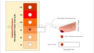 Estimation of Haemoglobin = Simplest Colour Scale Method to Determine Haemoglobin in Blood Sample