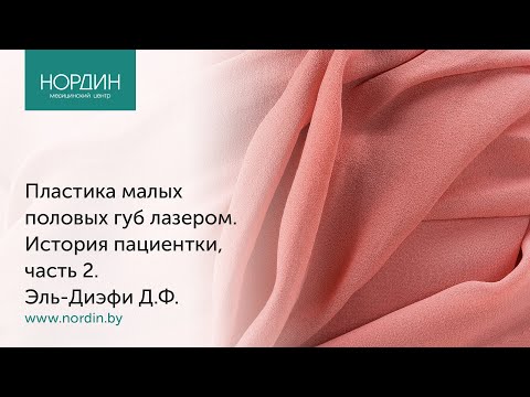 Пластика малых половых губ, реальная история пациентки, часть 2 - видео операции