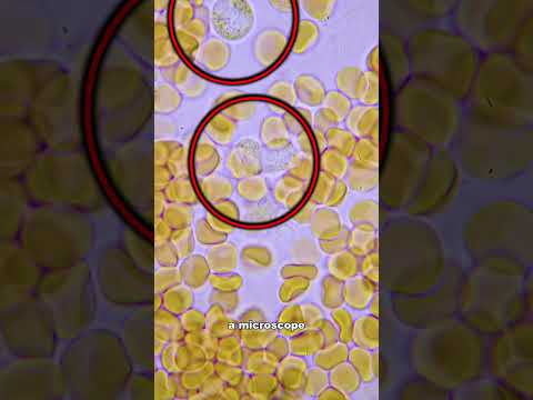 You Should NEVER Mix Different BLOOD TYPES 