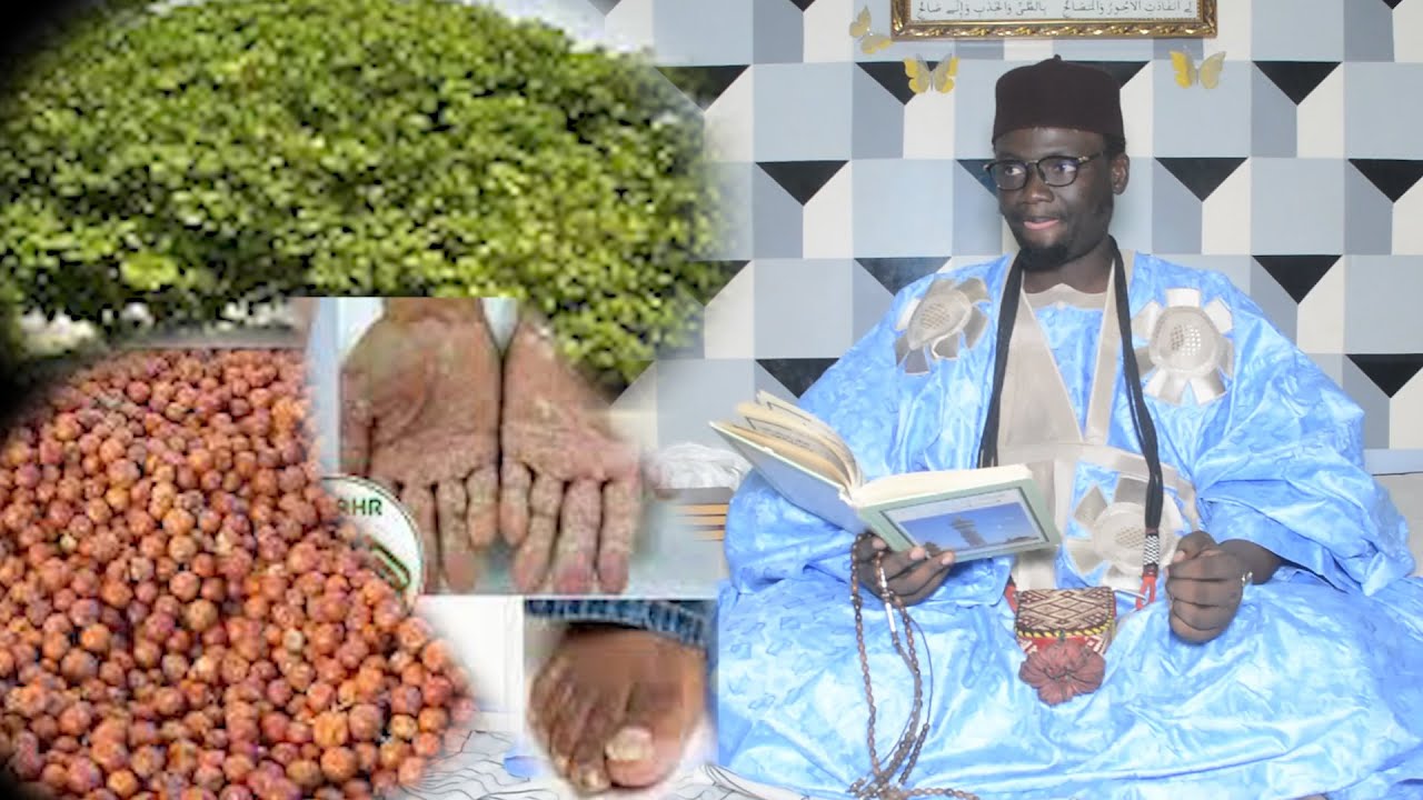 Ndiarigne Yi Nekk Ci Garabou Sideem Ak Maladie yim Mana Fadje Par Serigne Cheikh Fall Khataba