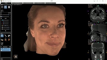 CS 9600 - Acquisition d