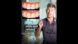 Icon White Spot Removal