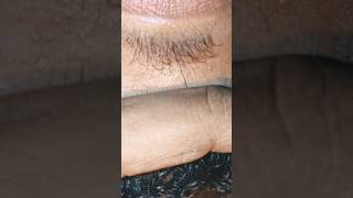 asmr #satisfying #message #thebarbersarms #blackheads #beard #asmr #relaxing #shortvideo #therapy