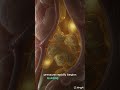 Gallstone Attack