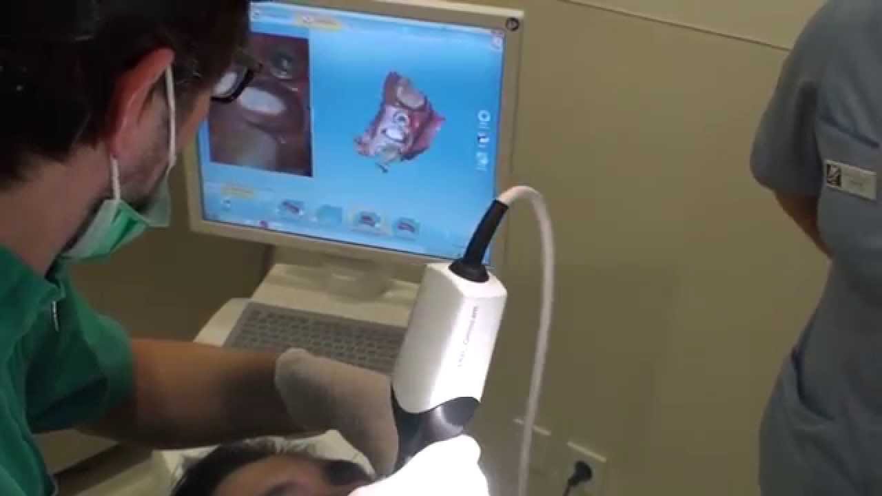 Sistema Cerec Cad-Cam - Omnicam. Implante + Dente. Estética Dentária ...