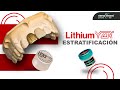 Estratificación de carillas ( lithium YZR y Heraceram 750)
