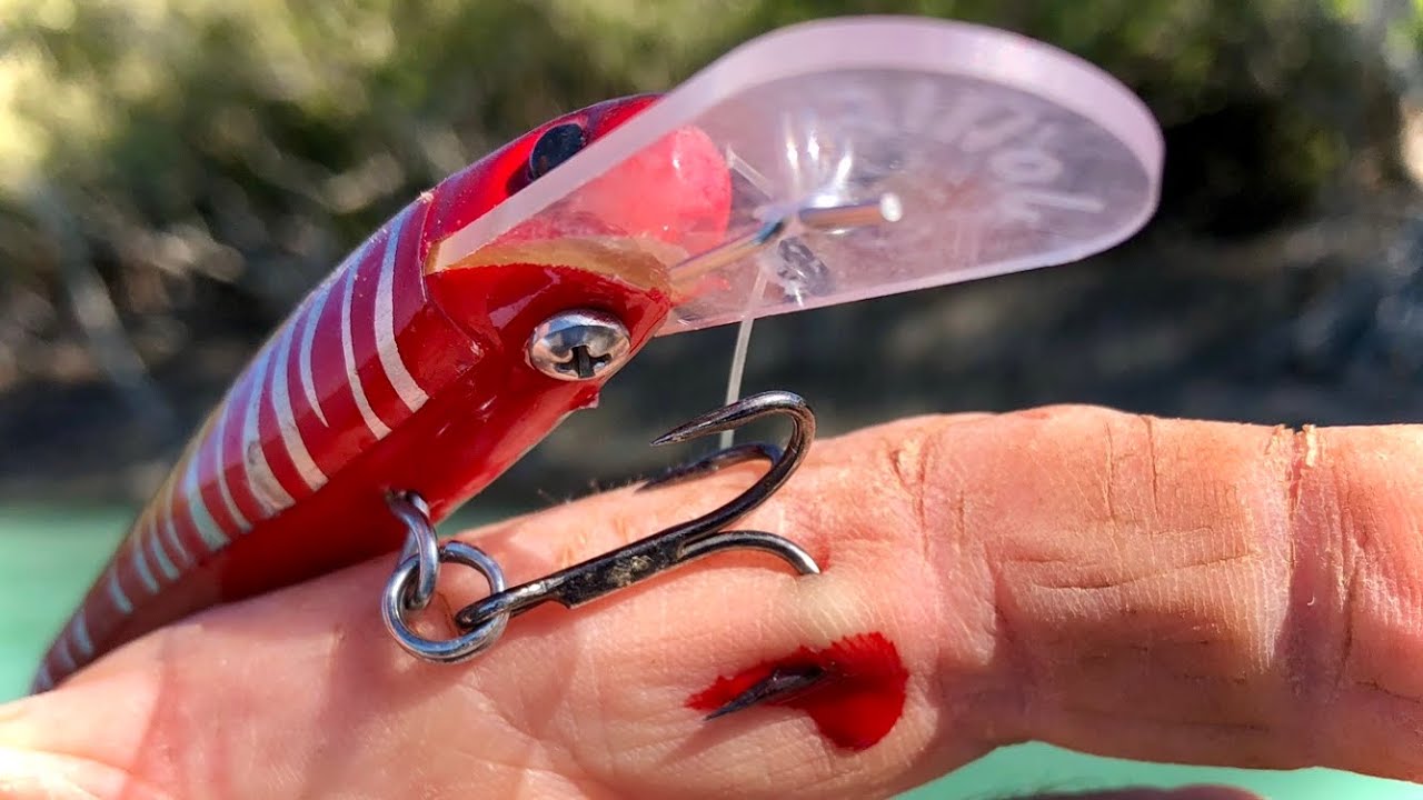 I HOOKED MYSELF! - How To Remove A Hook In Your Hand (Safest Way) 