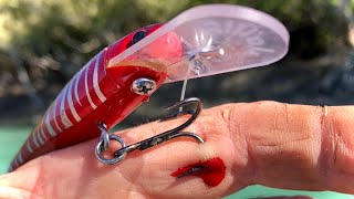 I HOOKED MYSELF! - How To Remove A Hook In Your Hand (Safest Way)