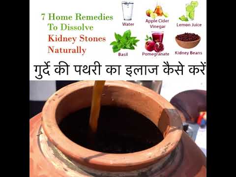 How to Cure Kidney Stones Naturally | Effective Home Remedies || गुर्दे की पथरी को कैसे ठीक करें ||