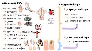 реактивные и инфекционные артриты