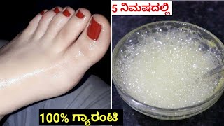 ಕೈ ಕಾಲು ಬೆಳ್ಳಗಾಗಲು ಮನೆಯಲ್ಲೇ ಬ್ಲೀಚ್ | Skin Whitening Natural Bleach At Home| Beauty tips Kannada | screenshot 2