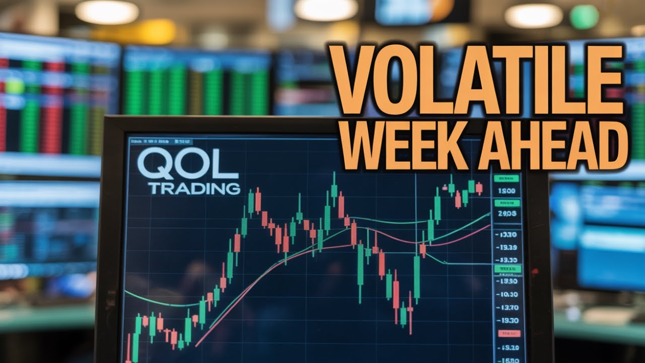 Your Options Levels for Monday's Market Open