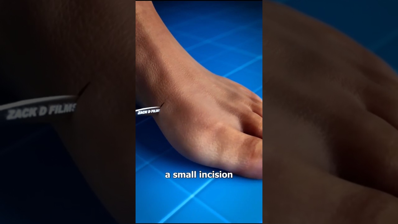 Doctor Ne Pair Ki Haddi Kaat Di 😱 | Bunion Surgery Explained in 3D