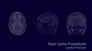 Basic neuroradiology procedures part 2 - Lumbar puncture