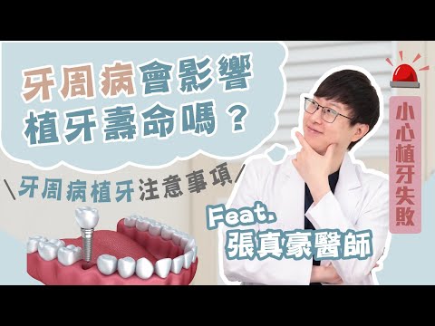 小心植牙失敗！牙周病會影響植牙壽命嗎？牙周病植牙注意事項 Ft.張真豪醫師【品悅牙醫】