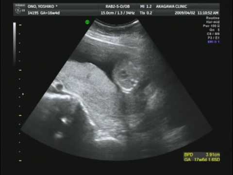 妊娠16週目のおなかの赤ちゃん 16 Weeks Pregnant Youtube
