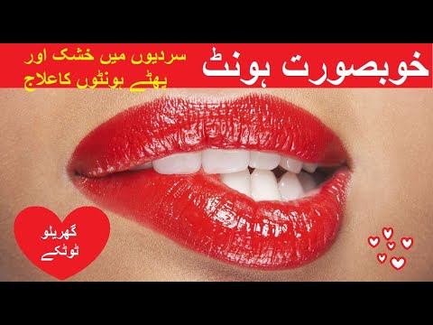 How To Get Rid Of Chapped Dry Lips  سردیوں میں خشک اورپھٹے ہونٹوں سے نجات پائیں،آسان گھریلوٹوٹکے۔۔