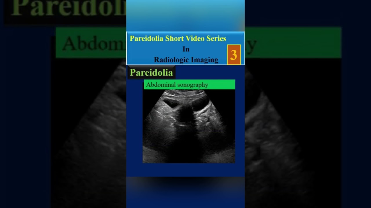 Pareidolia Short Video Series In Radiologic Imaging, Fox ( video3)# shorts