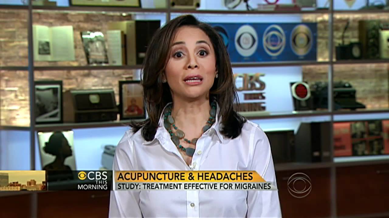 Acupuncture: Help for migraines?