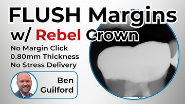 Flush Margins with no click transition with RebelCrown and Ben Guilford - ep 0038