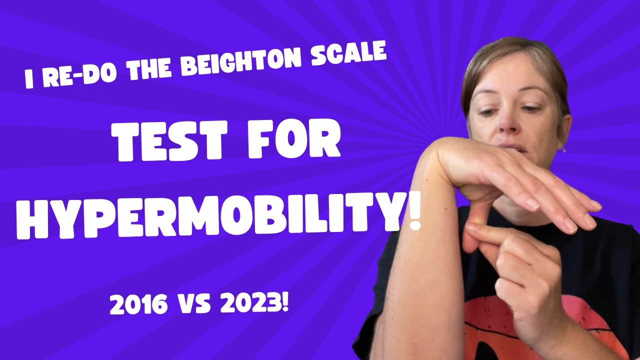 Autistic woman does the Beighton scale test for hypermobility! 7 years after first diagnosis
