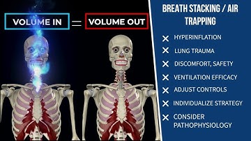 Mechanical Ventilation - Alarm Management, Part 1
